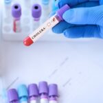 У Польщі перший випадок холери за шість років